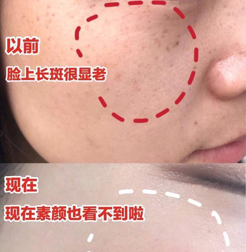 饲养大斑点的常见问题及解决方法（宠物爱好者必看，让你的大斑点健康成长）