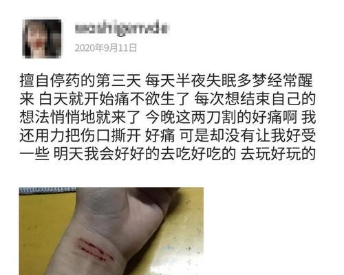 宠物抑郁症应该如何治疗？（以泰迪为例，探讨宠物抑郁症的原因和解决方法）