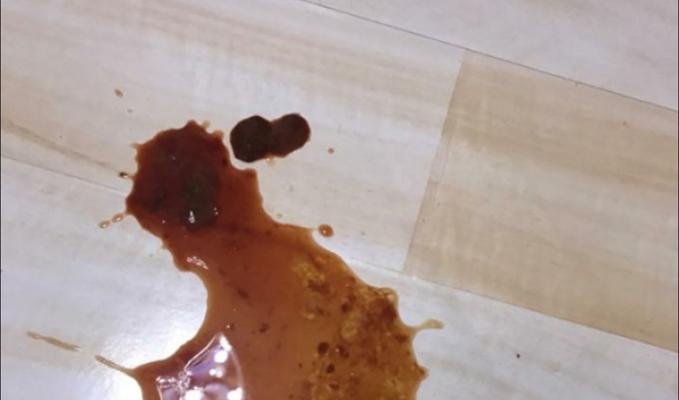 狗狗细小初期的症状是什么？（了解细小，保护爱宠）