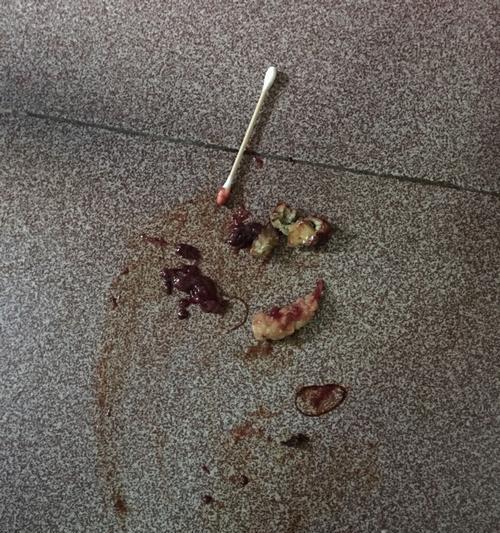小狗身上爆出大量虫子，主人们惊呆了！（揭开小狗身上爆虫的真相，如何预防和治疗虫害？）