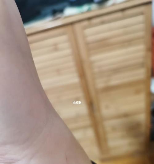 小猫爪子下的危害（宠物猫抓伤可能引发的健康问题）