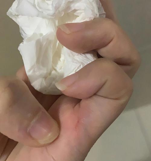 猫咬伤猫（如何处理猫咬伤猫的情况）