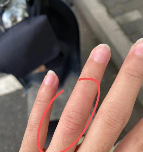 小狗咬伤我，但最终我们成为了好朋友（经历小狗的咬伤）