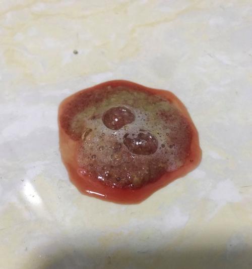 当猫咪拉便便带血，宠物主人必须知道的事情（了解猫咪肠道健康）