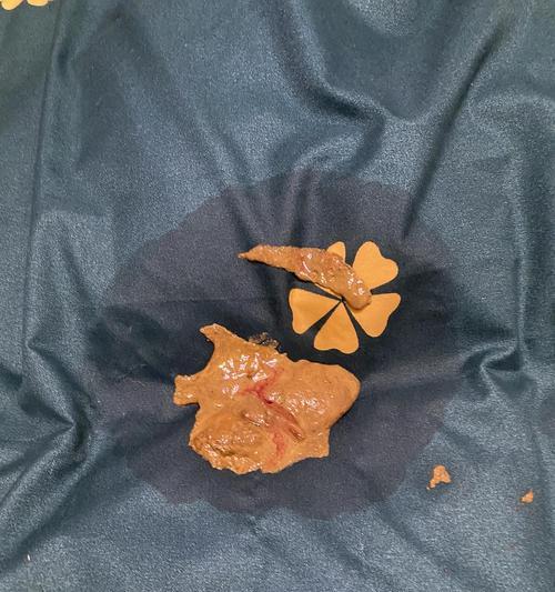 猫咪拉肚子，粪便酸酸怎么办（宠物猫的肠胃问题）