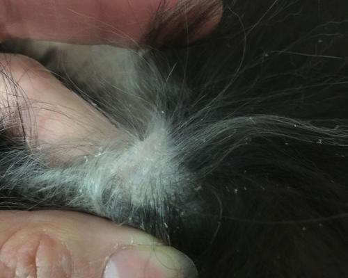 揭秘猫咪脸上黑色结痂的真相（从宠物角度探究猫咪脸上黑色结痂的成因）