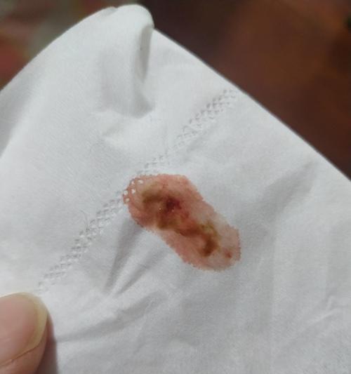 五个月猫咪的便便之谜（探究宠物猫咪排泄物的健康问题）