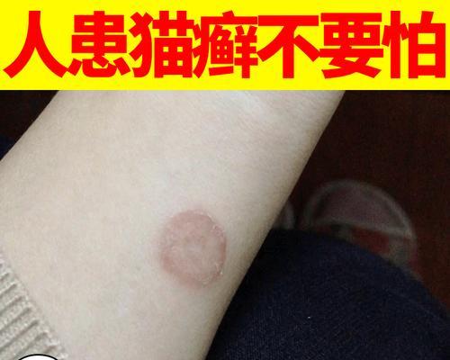 猫癣治疗费用大揭秘（宠物猫癣治疗费用详细解析）