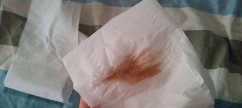 狗狗细小拉黄水的病因、症状及治疗方法（保护宠物健康）