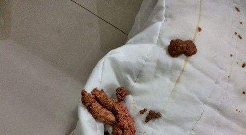 解决猫咪稀软大便问题的方法（宠物健康必备）