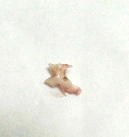 猫咪口腔健康（预防牙结石和牙龈炎是关键）