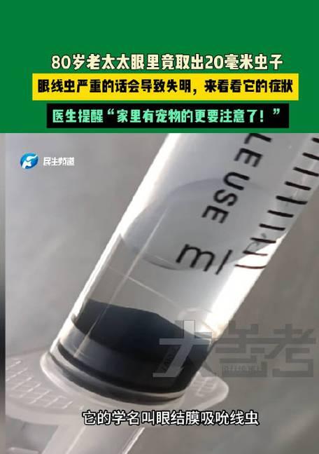 猫咪眼线虫感染人，宠物也有“传染病”（了解猫咪眼线虫）