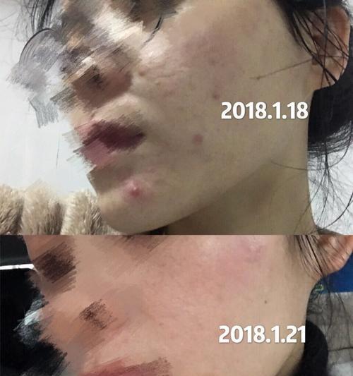 狗狗下巴长白色痘痘是怎么回事？如何处理？