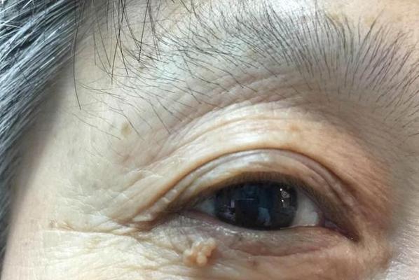 狗狗血脂高怎么治疗？有效降低血脂的方法有哪些？