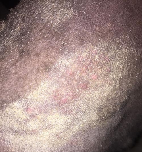 小狗头上出现红点并秃毛是怎么回事？