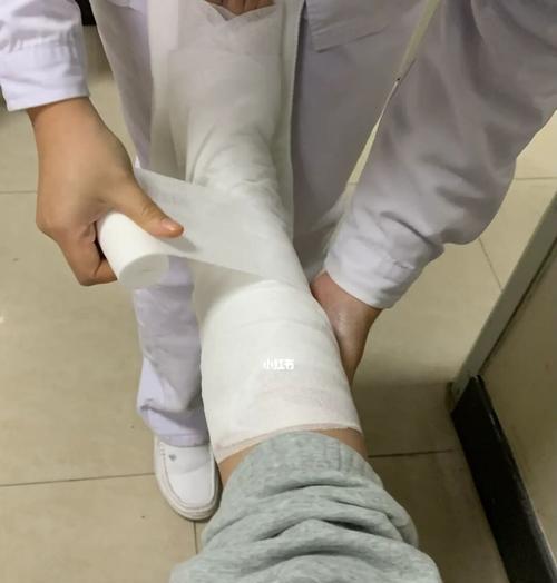 柴犬骨折拍片费用是多少？拍片后如何进行护理？