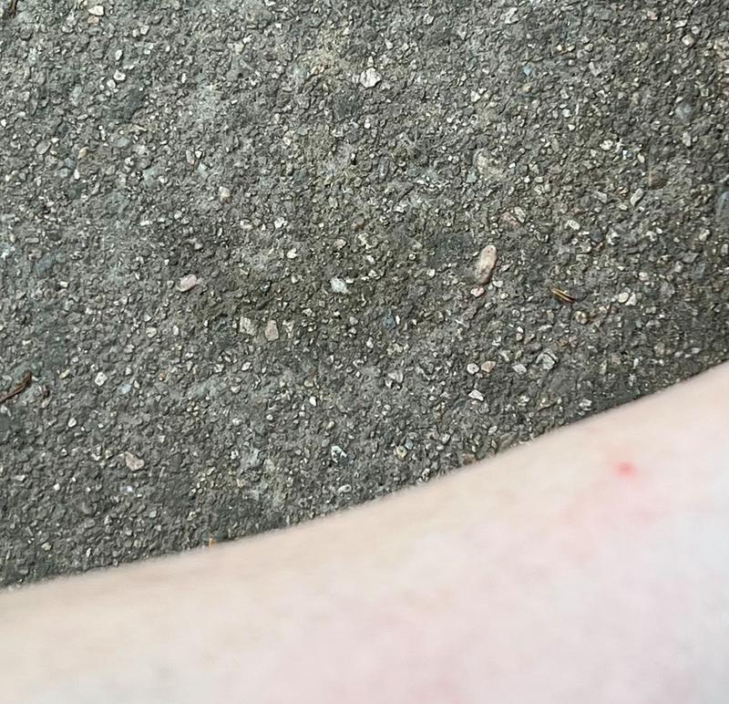 被羊驼咬伤出血应该怎么办？需要打针吗？